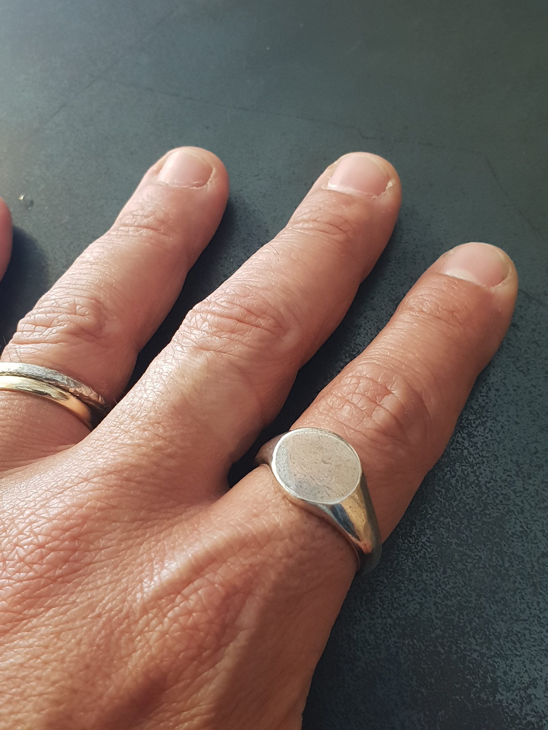 Ring Balmins